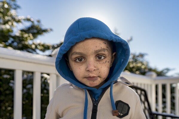 Omar Abu Kuwaik poses for a photo at the Global Medical Relief Fund residence, Wednesday, Jan. 17, 2024, in the Staten Island borough of New York. On Dec. 6, 2023 two Israeli airstrikes slammed into Omar's grandparents' home in the Nuseirat refugee camp, in central Gaza. The explosion peeled the skin from his face, exposing raw pink layers peppered with deep lacerations. His left arm could not be saved below the elbow. His parents, 6-year-old sister, grandparents, two aunts and a cousin were killed. (AP Photo/Peter K. Afriyie)
