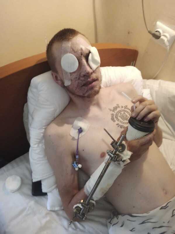 This handout photo shows injured Ukrainian soldier Ivan Soroka on his hospital bed in Vinnytsia, Ukraine on Aug. 26, 2022. (Courtesy of Vladislava Ryabets via AP)