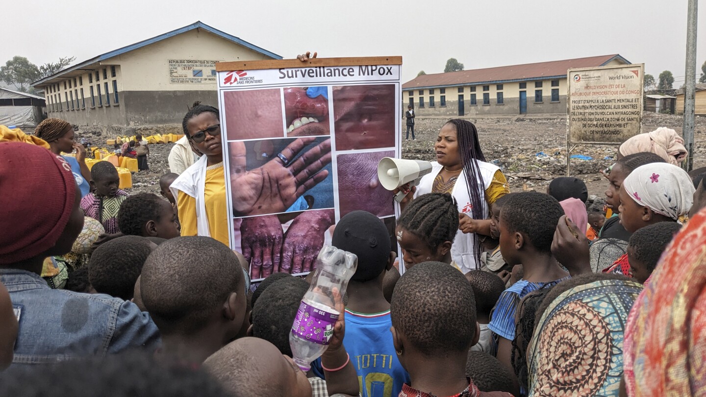 WHO declares mpox outbreaks in Africa a global health emergency