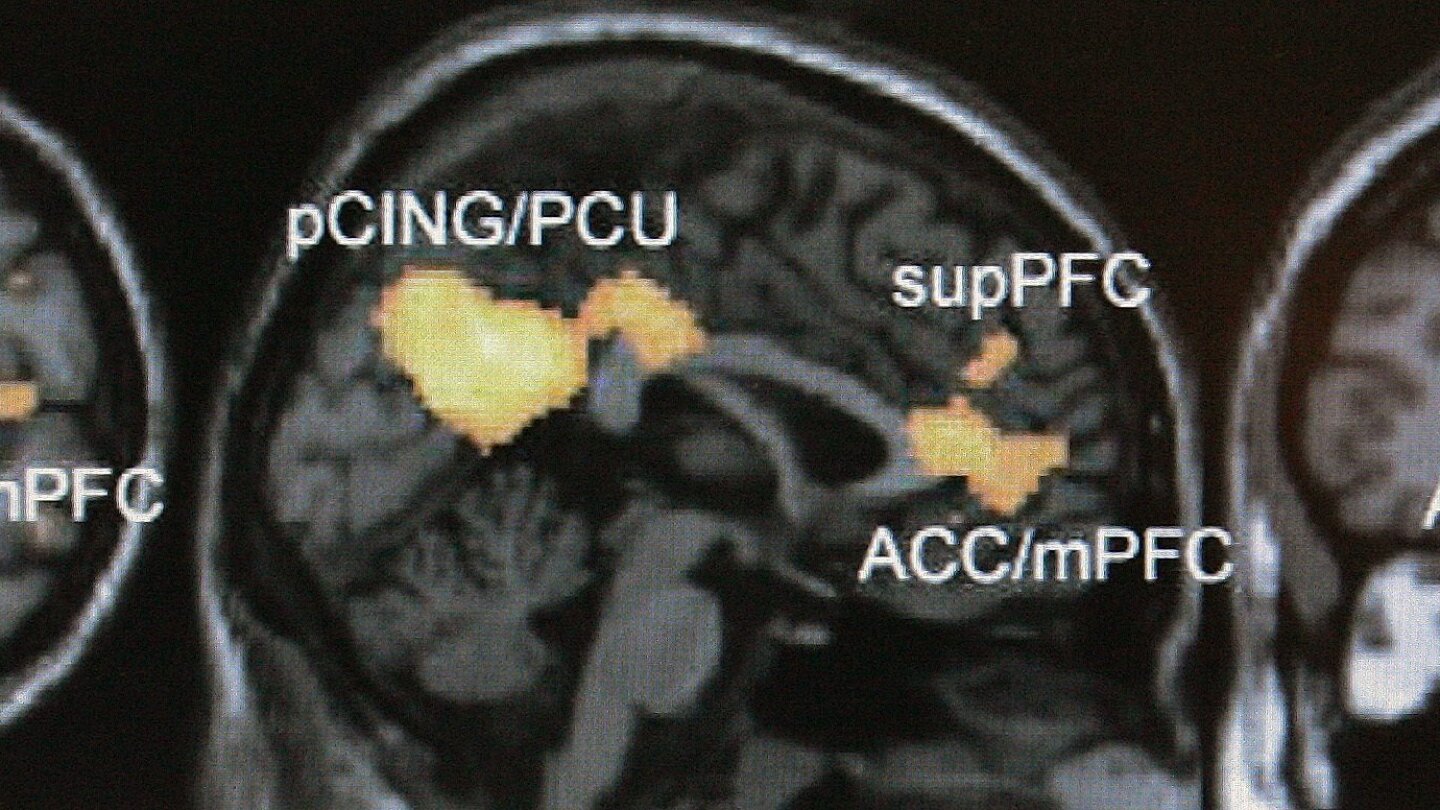 Identification of Anonymous MRI Research Participants with Face
