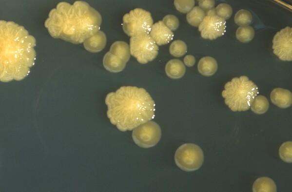 This photo provided by the Centers for Disease Control and Prevention shows Cronobacter sakazakii bacteria colonies in a petri dish in 1978. U.S. health officials will start formally tracking infections caused by the rare but potentially deadly germ that sickened babies and triggered a nationwide shortage of infant formula in 2022. A group that advises the Centers for Disease Control and Prevention agreed Thursday, June 29, 2023, to add infections caused by cronobacter to the list of serious conditions reported to the agency. (CDC via AP)