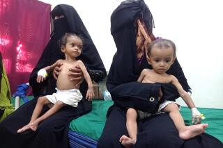 FILE - Women hold their malnourished children at Hays Rural Hospital in Hodeida, Yemen, Oct. 11, 2022. In many Middle Eastern and African nations, climatic shocks killed hundreds and displaced thousands every year, causing worsening food shortages. With limited resources, they also are among the world’s poorest and most vulnerable to climate change impacts. (AP Photo/Hussam Al-Bakry)