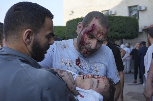 Palestinians wounded in Israeli air strikes on the Gaza Strip are brought to al-Aqsa hospital in Deir el-Balah City, Gaza Strip, Saturday, Oct. 14, 2023. (AP Photo/Hatem Moussa)